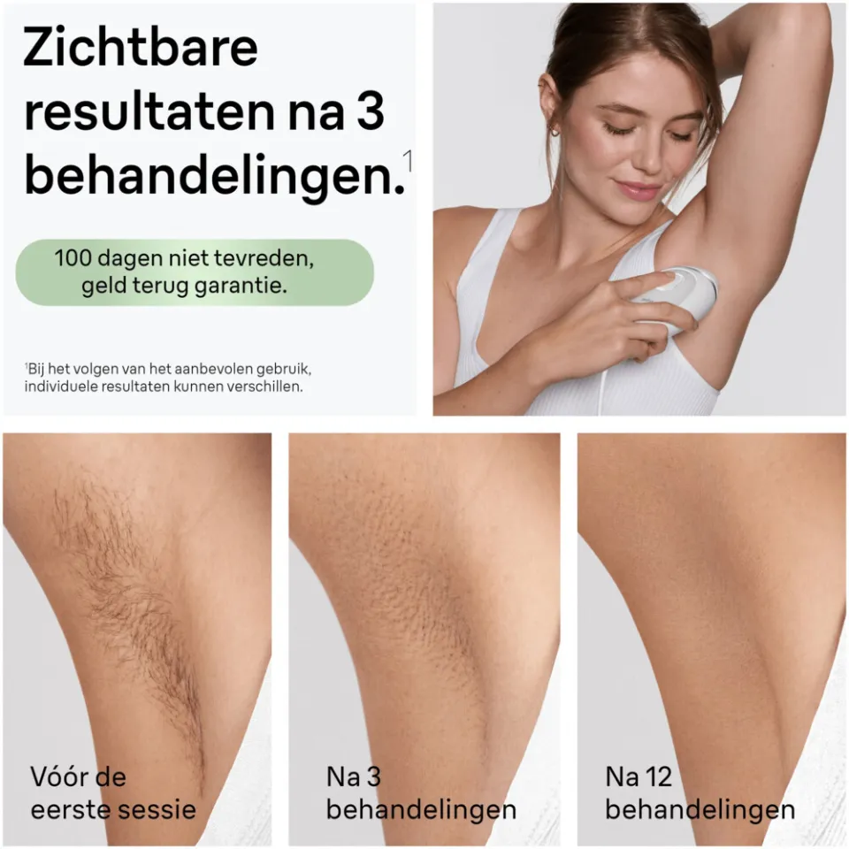 Braun Silk·expert Mini PL1114 ontharingsapparaat wit, foto 8